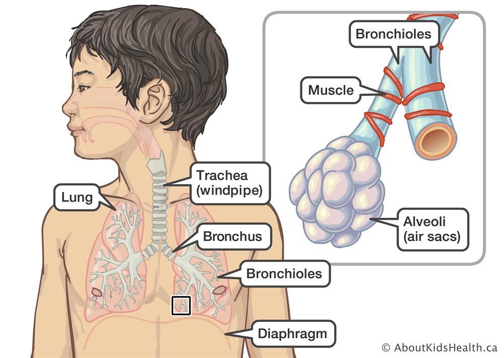 Bronchiolitis